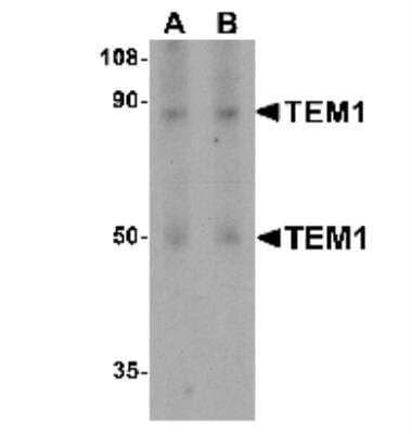 Western Blot: Endosialin/CD248/TEM1 Antibody [NBP1-77310] - Analysis of TEM1 in human colon tissue lysate with TEM1 antibody at (A) 0.5 and (B) 1 ug/mL.