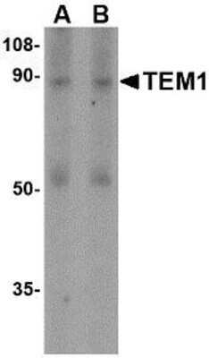 Western Blot: Endosialin/CD248/TEM1 Antibody [NBP1-77311] - Human colon tissue lysate with TEM1 antibody at (A) 0.5 and (B) 1 ug/ml.