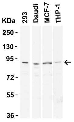 Western Blot: Endosialin/CD248/TEM1 Antibody [NBP1-77311] - Western Blot Validation in Human TissueLoading: 15 ug of lysates per lane.Antibodies: TEM-1 NBP1-77311, (0.5 ug/mL), 1h incubation at RT in 5% NFDM/TBST.Secondary: Goat anti-rabbit IgG HRP conjugate at 1:10000 dilution.