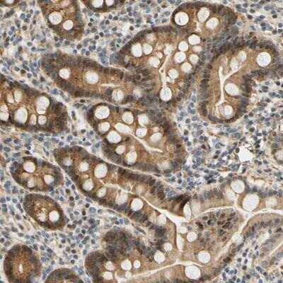 Immunohistochemistry: Endostatin Antibody [NBP1-89587] - Staining of human duodenum shows moderate cytoplasmic and nuclear positivity in glandular cells.