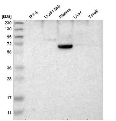Western Blot: Endostatin Antibody [NBP1-89587] - Analysis in human cell line RT-4, human cell line U-251 MG, human plasma, human liver tissue and human tonsil tissue.