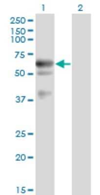 Western Blot: Endothelial Lipase Antibody (1E11) [H00009388-M02] - Analysis of LIPG expression in transfected 293T cell line by LIPG monoclonal antibody (M02), clone 1E11.Lane 1: LIPG transfected lysate(56.8 KDa).Lane 2: Non-transfected lysate.