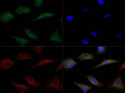 Immunocytochemistry/Immunofluorescence: Endothelial Lipase Antibody [NB400-118] - Antibody was tested in HeLa cells with Dylight 488 (green). Nuclei and alpha-tubulin were counterstained with DAPI (blue) and Dylight 550 (red).