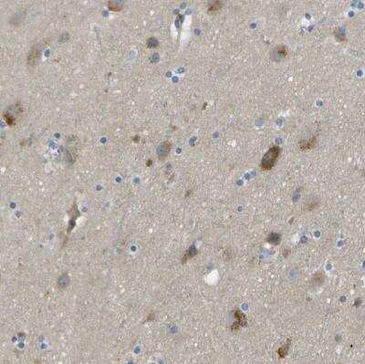 Immunohistochemistry-Paraffin: Endothelial Lipase Antibody [NBP1-84898] - Staining of human cerebral cortex shows moderate cytoplasmic positivity in neuronal cells.