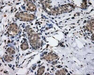 Immunohistochemistry: Endothelial Lipase Antibody (OTI1D9) - Azide and BSA Free [NBP2-71309] - Staining of paraffin-embedded Human breast tissue using anti-Endothelial Lipase mouse monoclonal antibody.