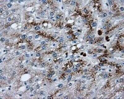 Immunohistochemistry: Endothelial Lipase Antibody (OTI1D9) - Azide and BSA Free [NBP2-71309] - Staining of paraffin-embedded Human liver tissue using anti-Endothelial Lipase mouse monoclonal antibody.