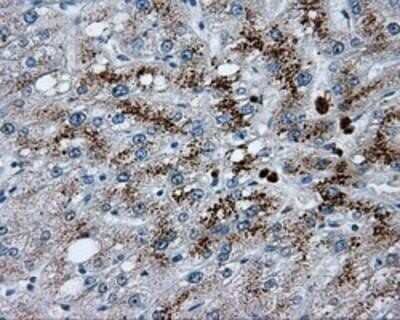 Immunohistochemistry-Paraffin: Endothelial Lipase Antibody (OTI1D9) [NBP2-02396] - Staining of paraffin-embedded Human liver tissue using anti-Endothelial Lipase mouse monoclonal antibody.