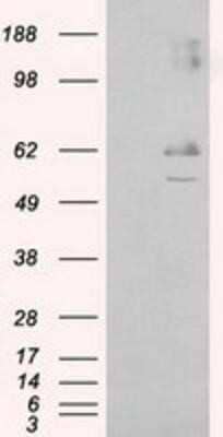 Western Blot: Endothelial Lipase Antibody (OTI1D9) [NBP2-02396] - HEK293T cells were transfected with the pCMV6-ENTRY control (Left lane) or pCMV6-ENTRY Endothelial Lipase (Right lane) cDNA for 48 hrs and lysed. Equivalent amounts of cell lysates (5 ug per lane) were separated by SDS-PAGE and immunoblotted with anti-Endothelial Lipase.