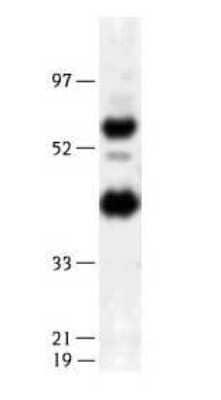 Western Blot: Endothelial Lipase Antibody [NB400-118] - Human endothelial lipase detected in transfected 293 lysates using NB 400-118. (MW 57 kD)