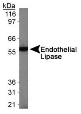 Western Blot: Endothelial Lipase Antibody [NB400-118] - Analysis of Endothelial Lipase in ECV304 cells.