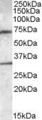 Western Blot: Endothelial Lipase Antibody [NBP1-05031] - Analysis of Endothelial Lipase in Human Liver lysate using NBP1-05031 at 0.3ug/ml (35ug protein in RIPA buffer). Primary incubation was 1 hour. Detected by chemiluminescence.