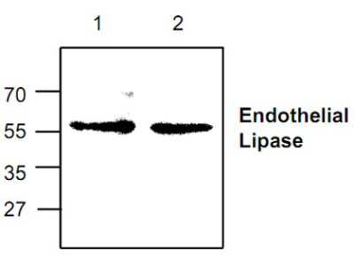 Western Blot: Endothelial Lipase Antibody [NBP1-45541] - Analysis of Endothelial Lipase with Jurkat cell lysate.