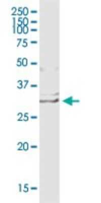 Western Blot: Endothelin-1 Antibody [H00001906-B01P] - Analysis of EDN1 expression in human placenta.