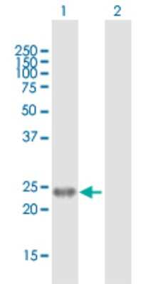 Western Blot: Endothelin-1 Antibody [H00001906-B01P] - Analysis of EDN1 expression in transfected 293T cell line by EDN1 polyclonal antibody.  Lane 1: EDN1 transfected lysate(23.32 KDa). Lane 2: Non-transfected lysate.