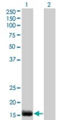 Western Blot Endothelin 2 Antibody (3B4-1C5)