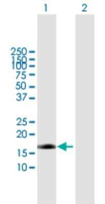 Western Blot: Endothelin 2 Antibody [H00001907-B01P] - Analysis of EDN2 expression in transfected 293T cell line by EDN2 polyclonal antibody.  Lane 1: EDN2 transfected lysate(19.58 KDa). Lane 2: Non-transfected lysate.