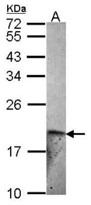 Western Blot Endothelin 2 Antibody