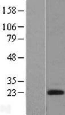 Western Blot Endothelin 2 Overexpression Lysate