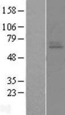 Western Blot: Endothelin A Receptor Overexpression Lysate (Adult Normal) [NBL1-10117] Left-Empty vector transfected control cell lysate (HEK293 cell lysate); Right -Over-expression Lysate for Endothelin A Receptor.