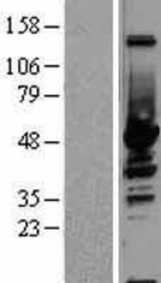 Western Blot: Enolase 1 Overexpression Lysate (Adult Normal) [NBL1-10267] Left-Empty vector transfected control cell lysate (HEK293 cell lysate); Right -Over-expression Lysate for Enolase 1.