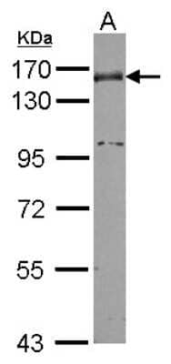 Western Blot: Nidogen-1/Entactin Antibody [NBP2-16341] - Sample (30 ug of whole cell lysate) A: NT2D1 7. 5% SDS PAGE gel, diluted at 1:1000.