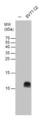 Western Blot: Enterovirus 71 2B Antibody [NBP3-13090] - EV71 2B antibody detects EV71 2B protein by western blot analysis. Un-infected (-) and infected with EV71 C2 strain RD whole cell extracts (30 ug) were separated by 15% SDS-PAGE, and the membrane was blotted with EV71 2B antibody (NBP3-13090) at a dilution of 1:1000.