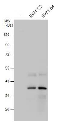 Western Blot: Enterovirus 71 2C Antibody [NBP3-13095] - Non-infected (-) and infected RD cell extracts (30 ug) were separated by 10% SDS-PAGE, and the membrane was blotted with EV71 protein 2C antibody (NBP3-13095) diluted at 1:5000.