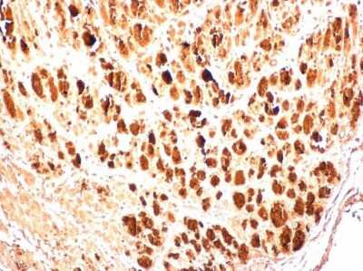 Immunohistochemistry-Paraffin: Enterovirus 71 3AB Antibody [NBP3-13091] - EV71 3AB antibody detects EV71 3AB protein in EV71 infected mouse skeletal muscle by immunohistochemical analysis. Sample: Paraffin-embedded EV71 infected mouse skeletal muscle. EV71 3AB antibody [NBP3-13091] diluted at 1:500 Antigen Retrieval: Citrate buffer