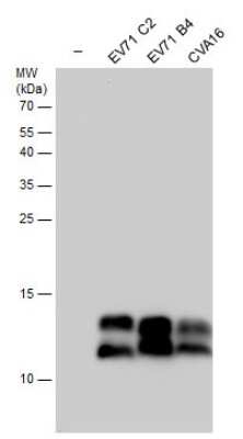 Western Blot: Enterovirus 71 3AB Antibody [NBP3-13091] - Non-infected (-) and infected RD whole cell extracts (30 ug) were separated by 15% SDS-PAGE, and the membrane was blotted with Enterovirus 71 3AB antibody (NBP3-13091) diluted at 1:5000.