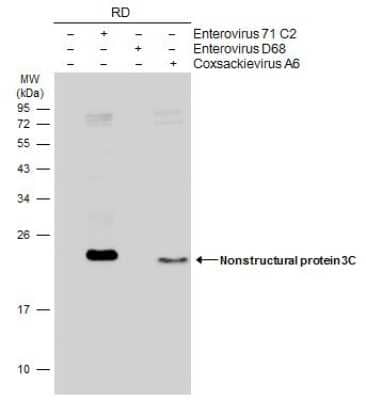 Western Blot: Enterovirus 71 3C Antibody (B3) [NBP3-13501] - Non-infected (-) and infected (+) RD whole cell extracts (20 ug) were separated by 12% SDS-PAGE, and the membrane was blotted with Enterovirus 71 3C antibody [B3] (NBP3-13501) diluted at 1:1000. The HRP-conjugated anti-mouse IgG antibody (NBP2-19382) was used to detect the primary antibody.