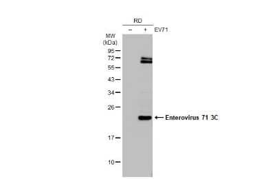 Western Blot: Enterovirus 71 3C Antibody (B3) [NBP3-13501] - Non-infected (-) and infected (+) RD whole cell extracts (30 ug) were separated by 12% SDS-PAGE, and the membrane was blotted with Enterovirus 71 3C antibody [B3] (NBP3-13501) diluted at 1:5000. The HRP-conjugated anti-mouse IgG antibody (NBP2-19382) was used to detect the primary antibody.
