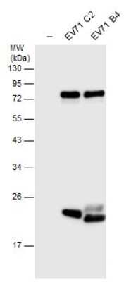Western Blot: Enterovirus 71 3C Antibody [NBP3-13098] - Non-infected (-) and infected RD whole cell extracts (30 ug) were separated by 12% SDS-PAGE, and the membrane was blotted with Enterovirus 71 3C antibody (NBP3-13098) diluted at 1:5000.