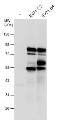 Western Blot: Enterovirus 71 3CD Antibody [NBP3-13096] - Non-infected (-) and infected RD cell extracts (30 ug) were separated by 10% SDS-PAGE, and the membrane was blotted with EV71 protein 3CD antibody (NBP3-13096) diluted at 1:10000.