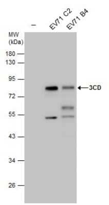 Western Blot: Enterovirus 71 3CD Antibody [NBP3-13097] - Non-infected (-) and infected RD cell extracts (30 ug) were separated by 10% SDS-PAGE, and the membrane was blotted with EV71 3CD antibody (NBP3-13097) diluted at 1:3000.