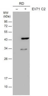 Western Blot: Enterovirus 71 VP1 Antibody (GT9512) [NBP3-13544] - Non-infected (-) and infected (+) RD whole cell extracts (30 ug) were separated by 12% SDS-PAGE, and the membrane was blotted with Enterovirus 71 VP1 antibody [GT9512] (NBP3-13544) diluted at 1:500.