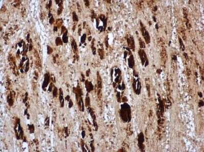 Immunohistochemistry-Paraffin: Enterovirus 71 VP1 Antibody [NBP3-13086] - EV71 VP1 antibody detects EV71 VP1 protein in EV71 infected mouse skeletal muscle by immunohistochemical analysis. Sample: Paraffin-embedded EV71 infected mouse skeletal muscle. EV71 VP1 antibody [NBP3-13086] diluted at 1:500 Antigen Retrieval: Citrate buffer