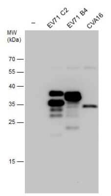 Western Blot: Enterovirus 71 VP1 Antibody [NBP3-13086] - Non-infected (-) and infected RD whole cell extracts (30 ug) were separated by 12% SDS-PAGE, and the membrane was blotted with Enterovirus 71 VP1 antibody (NBP3-13086) diluted at 1:5000. The HRP-conjugated anti-rabbit IgG antibody (NBP2-19301) was used to detect the primary antibody.