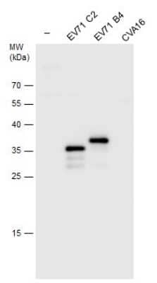 Western Blot: Enterovirus 71 VP1 Antibody [NBP3-13087] - Non-infected (-) and infected RD whole cell extracts (30 ug) were separated by 12% SDS-PAGE, and the membrane was blotted with Enterovirus 71 VP1 antibody (NBP3-13087) diluted at 1:5000.