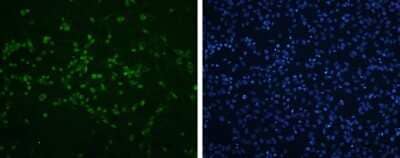 Immunocytochemistry/Immunofluorescence: Enterovirus 71 VP2 Antibody [NBP3-13088] - EV71 VP2 antibody detects EV71 VP2 protein by immunofluorescent analysis. Sample: RD cells infected with EV71 were fixed in 4% paraformaldehyde. Green: EV71 VP2 protein stained by EV71 VP2 antibody (NBP3-13088) diluted at 1:500. Blue: DAPI staining. Scale bar = 500 um.
