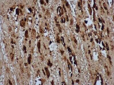 Immunohistochemistry-Paraffin: Enterovirus 71 VP2 Antibody [NBP3-13088] - EV71 VP2 antibody detects EV71 VP2 protein in EV71 infected mouse skeletal muscle by immunohistochemical analysis. Sample: Paraffin-embedded EV71 infected mouse skeletal muscle. EV71 VP2 antibody [NBP3-13088] diluted at 1:500 Antigen Retrieval: Citrate buffer