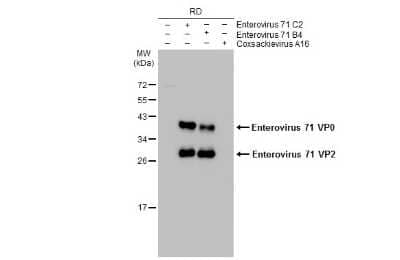 Western Blot: Enterovirus 71 VP2 Antibody [NBP3-13088] - Non-infected (-) and infected (+) RD whole cell extracts (15 ug) were separated by 12% SDS-PAGE, and the membrane was blotted with Enterovirus 71 VP2 antibody (NBP3-13088) diluted at 1:5000. The HRP-conjugated anti-rabbit IgG antibody (NBP2-19301) was used to detect the primary antibody.