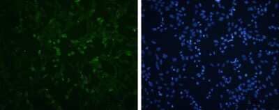 Immunocytochemistry/Immunofluorescence: Enterovirus 71 VP3 Antibody [NBP3-13089] - EV71 VP3 antibody detects EV71 VP3 protein by immunofluorescent analysis. Sample: RD cells infected with EV71 were fixed in 4% paraformaldehyde. Green: EV71 VP3 protein stained by EV71 VP3 antibody (NBP3-13089) diluted at 1:100. Blue: DAPI staining. Scale bar = 500 um.