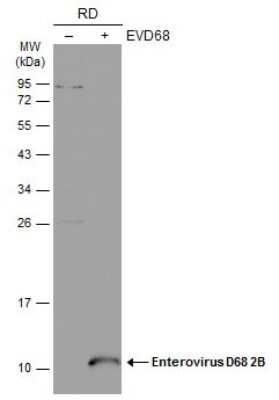 Western Blot: Enterovirus D68 2B Antibody [NBP3-13387] - Non-infected (-) and infected (+) RD whole cell extracts (30 ug) were separated by 12% SDS-PAGE, and the membrane was blotted with Enterovirus D68 2B antibody (NBP3-13387) diluted at 1:1000. The HRP-conjugated anti-rabbit IgG antibody (NBP2-19301) was used to detect the primary antibody.