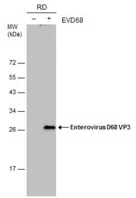 Western Blot: Enterovirus D68 VP3 Antibody (GT1665) [NBP3-13561] - Non-infected (-) and infected (+) RD whole cell extracts (15 ug) were separated by 12% SDS-PAGE, and the membrane was blotted with Enterovirus D68 VP3 antibody [GT1665] (NBP3-13561) diluted at 1:1000.