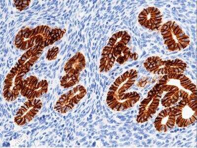 Immunohistochemistry-Paraffin: EpCAM/TROP1 Antibody (065) [NBP2-90654] - Staining of mouse EpCAM in mouse uterus with rabbit monoclonal antibody (1:200). 