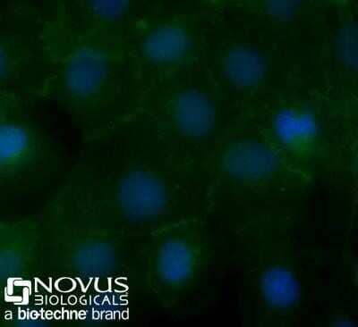 Immunocytochemistry/Immunofluorescence: EpCAM/TROP1 Antibody (AUA1) - Azide and BSA Free [NBP2-80721] - A431 cells were fixed for 10 minutes using 10% formalin and then permeabilized for 5 minutes using 1X PBS + 0.05% Triton X-100. The cells were incubated with anti-EpCAM/TROP1 (AUA1) conjugated to Alexa Fluor 488 [NB600-1182AF488] at 10ug/ml for 1 hour at room temperature. Nuclei were counterstained with DAPI (blue). Cells were imaged using a 40X objective.