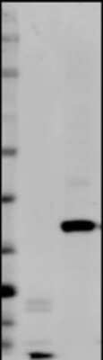 Western Blot: EpCAM/TROP1 Antibody (AUA1) - Azide and BSA Free [NBP2-80721] - Detection of EpCAM/CD326 in two Human mammary tumor cell lines, MDA-MB-231 (mesenchyme-like) and MCF-7 (epithelium-like). Dilution: 1:500 in PBS with 5% BSA. Secondary Ab: anti-Mouse IgG 1:5,000. This image was submitted via customer Review. Image from the standard format of this antibody.