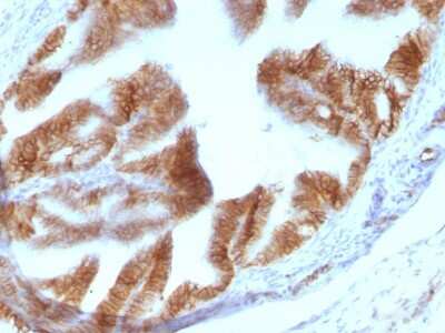 Immunohistochemistry-Paraffin: EpCAM/TROP1 Antibody (EGP40/1110) - (ECD) - IHC-Prediluted [NBP2-48264] - Formalin-fixed, paraffin-embedded Rat Oviduct stained with EpCAM Mouse Monoclonal Antibody (EGP40/1110).