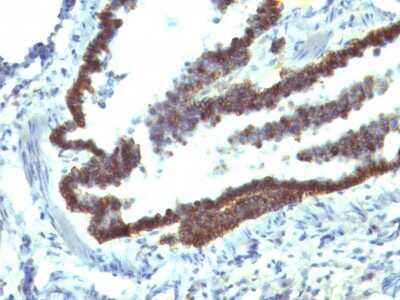 Immunohistochemistry-Paraffin: EpCAM/TROP1 Antibody (EGP40/1110) - (ECD) - IHC-Prediluted [NBP2-48264] - Formalin-fixed, paraffin-embedded Rat Lung stained with EpCAM Mouse Monoclonal Antibody (EGP40/1110).