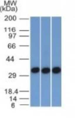 Western Blot: EpCAM/TROP1 Antibody (EGP40/1372) - (ECD) - Azide and BSA Free [NBP2-54419] - 293, A431 and HCT116 Cell Lysate using EpCAM, Monoclonal Antibody (EGP40/1372).